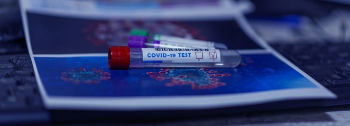 Pruebas diagnósticas coronavirus covid-19
